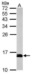 Anti-Profilin 2 antibody used in Western Blot (WB). GTX108589