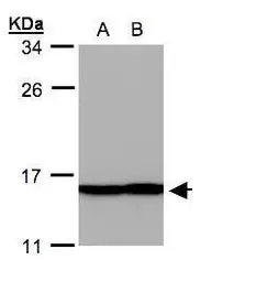 Anti-Profilin 2 antibody used in Western Blot (WB). GTX108589