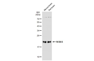 Anti-N-RAS antibody used in Western Blot (WB). GTX108598