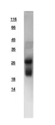 Human RHOB protein, His tag. GTX108600-pro