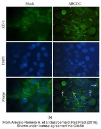 Anti-ZO-1 antibody [N1N2], N-term used in Immunocytochemistry/ Immunofluorescence (ICC/IF). GTX108613