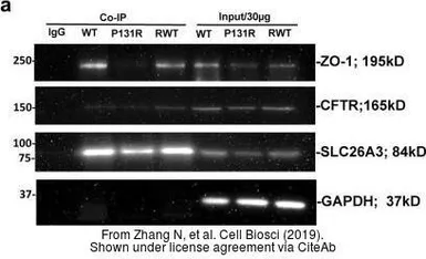 Anti-ZO-1 antibody [N1N2], N-term used in Western Blot (WB). GTX108613