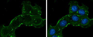 Anti-ZO-1 antibody [N1N2], N-term used in Immunocytochemistry/ Immunofluorescence (ICC/IF). GTX108613