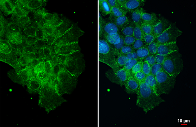 Anti-ZO-1 antibody [N1N2], N-term used in Immunocytochemistry/ Immunofluorescence (ICC/IF). GTX108613