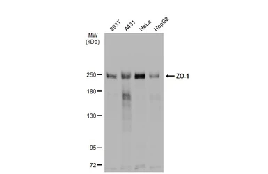 Anti-ZO-1 antibody [N1N2], N-term used in Western Blot (WB). GTX108613