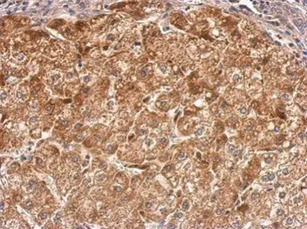 Anti-RASGRP2 antibody used in IHC (Paraffin sections) (IHC-P). GTX108616