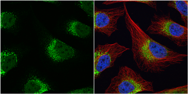 Anti-Fibrinogen gamma antibody used in Immunocytochemistry/ Immunofluorescence (ICC/IF). GTX108640