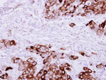 Anti-Fibrinogen gamma antibody used in IHC (Paraffin sections) (IHC-P). GTX108640