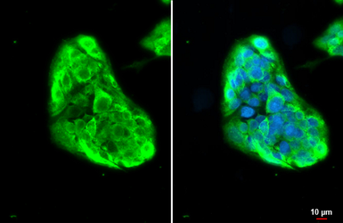 Anti-Fibrinogen gamma antibody used in Immunocytochemistry/ Immunofluorescence (ICC/IF). GTX108640