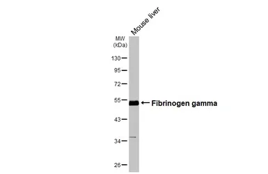 Anti-Fibrinogen gamma antibody used in Western Blot (WB). GTX108640