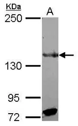 Anti-RFX1 antibody used in Western Blot (WB). GTX108664