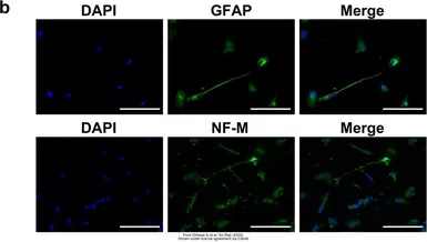 Anti-GFAP antibody used in Immunocytochemistry/ Immunofluorescence (ICC/IF). GTX108711