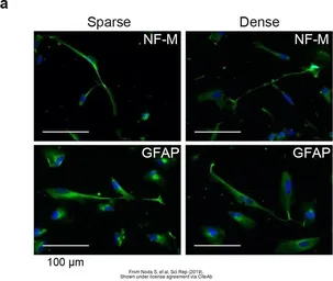 Anti-GFAP antibody used in Immunocytochemistry/ Immunofluorescence (ICC/IF). GTX108711