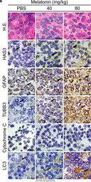 Anti-GFAP antibody used in IHC (Frozen sections) (IHC-Fr). GTX108711