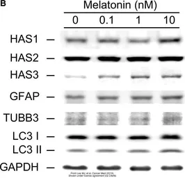 Anti-GFAP antibody used in Western Blot (WB). GTX108711