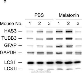 Anti-GFAP antibody used in Western Blot (WB). GTX108711