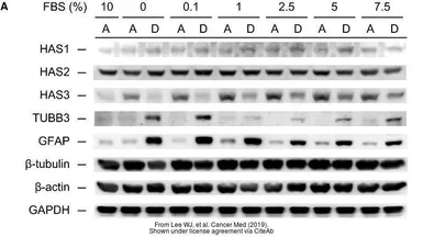 Anti-GFAP antibody used in Western Blot (WB). GTX108711