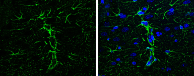 Anti-GFAP antibody used in IHC (Paraffin sections) (IHC-P). GTX108711