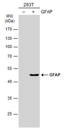 Anti-GFAP antibody used in Western Blot (WB). GTX108711