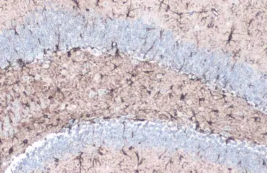 Anti-GFAP antibody used in IHC (Paraffin sections) (IHC-P). GTX108711