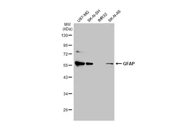 Anti-GFAP antibody used in Western Blot (WB). GTX108711