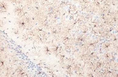 Anti-GFAP antibody used in IHC (Paraffin sections) (IHC-P). GTX108711