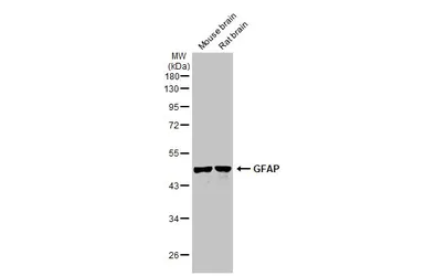 Anti-GFAP antibody used in Western Blot (WB). GTX108711