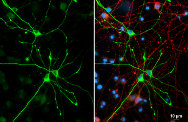 Anti-GFAP antibody used in Immunocytochemistry/ Immunofluorescence (ICC/IF). GTX108711