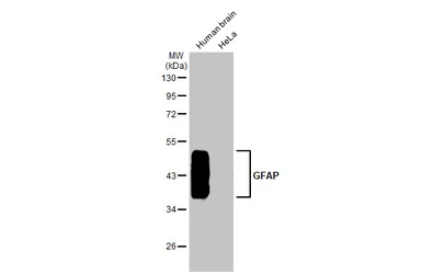 Anti-GFAP antibody used in Western Blot (WB). GTX108711