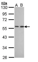 Anti-DPP2 antibody [N3C3-2] used in Western Blot (WB). GTX108734