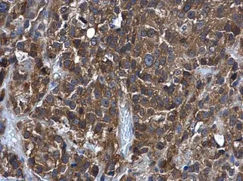 Anti-GSTM5 antibody used in IHC (Paraffin sections) (IHC-P). GTX108776