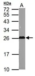 Anti-GSTM5 antibody used in Western Blot (WB). GTX108776