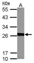 Anti-GSTM5 antibody used in Western Blot (WB). GTX108776