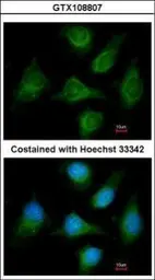 Anti-Cav beta 1 antibody [C1C3] used in Immunocytochemistry/ Immunofluorescence (ICC/IF). GTX108807