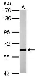 Anti-Cav beta 1 antibody [C1C3] used in Western Blot (WB). GTX108807