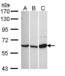 Anti-Cav beta 1 antibody [C1C3] used in Western Blot (WB). GTX108807