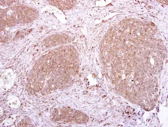 Anti-LILRA3 antibody [N2C2], Internal used in IHC (Paraffin sections) (IHC-P). GTX108819