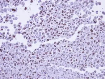 Anti-POLR2G antibody used in IHC (Paraffin sections) (IHC-P). GTX108874