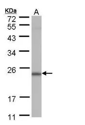 Anti-POLR2G antibody used in Western Blot (WB). GTX108874