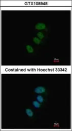 Anti-XPD antibody used in Immunocytochemistry/ Immunofluorescence (ICC/IF). GTX108948