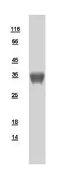 Human PPP6C protein, His tag. GTX108968-pro