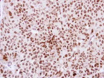 Anti-DKC1 antibody used in IHC (Paraffin sections) (IHC-P). GTX109000