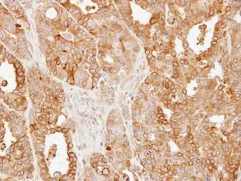 Anti-SLC25A13 antibody [N3C2], Internal used in IHC (Paraffin sections) (IHC-P). GTX109001