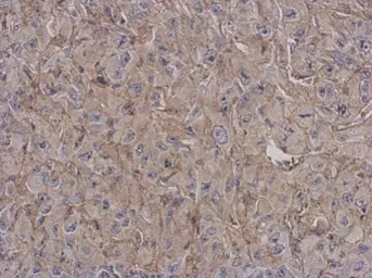 Anti-RP105 antibody [N2C1], Internal used in IHC (Paraffin sections) (IHC-P). GTX109057