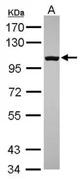 Anti-RP105 antibody [N2C1], Internal used in Western Blot (WB). GTX109057