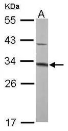 Anti-MTAP antibody [N1C3] used in Western Blot (WB). GTX109117