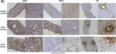 Anti-Glutamine synthetase antibody used in IHC (Paraffin sections) (IHC-P). GTX109121