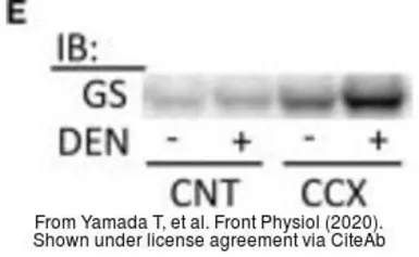 Anti-Glutamine synthetase antibody used in Western Blot (WB). GTX109121