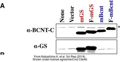 Anti-Glutamine synthetase antibody used in Western Blot (WB). GTX109121