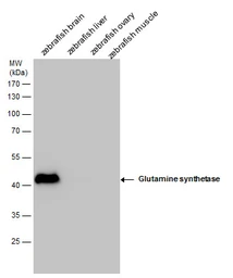 Anti-Glutamine synthetase antibody used in Western Blot (WB). GTX109121